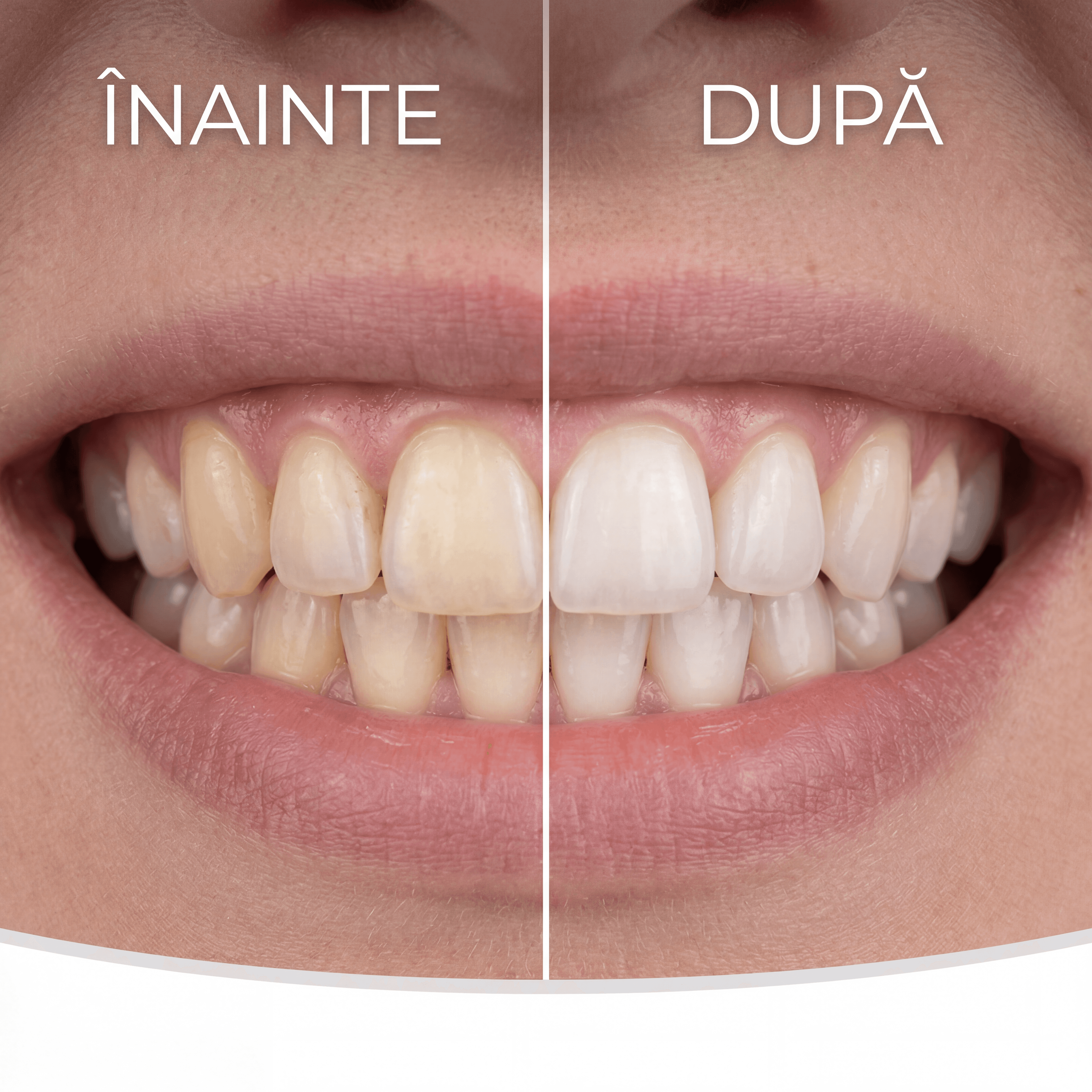 Estetica Dentara